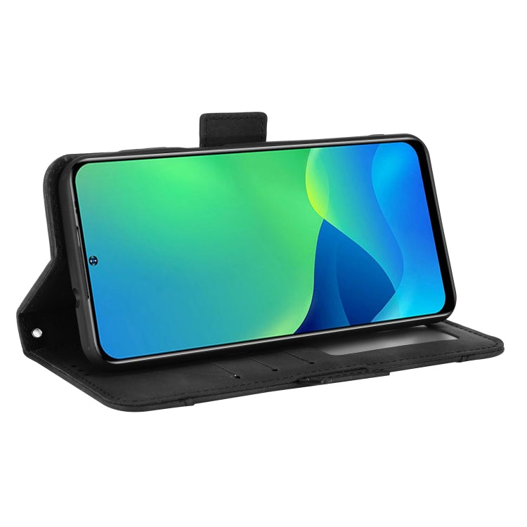 For Ulefone Note 13P Skin Feel Calf Pattern Leather Phone Case(Black) - Ulefone Cases by PMC Jewellery | Online Shopping South Africa | PMC Jewellery | Buy Now Pay Later Mobicred