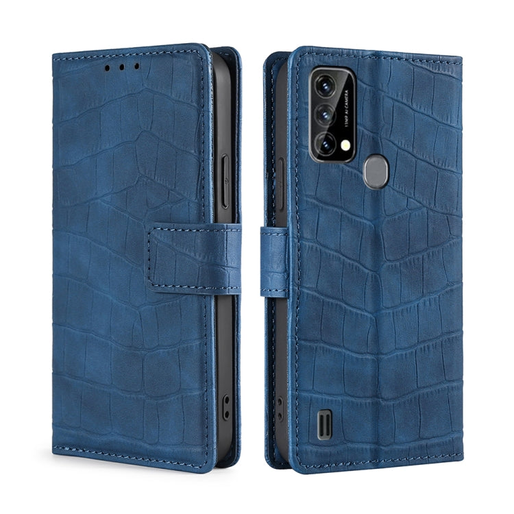 For Blackview A50 Skin Feel Crocodile Magnetic Clasp Leather Phone Case(Blue) - More Brand by PMC Jewellery | Online Shopping South Africa | PMC Jewellery | Buy Now Pay Later Mobicred