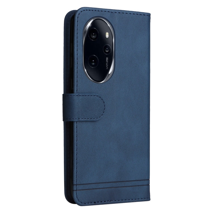 For Honor 100 Pro Skin Feel Life Tree Metal Button Leather Phone Case(Blue) - Honor Cases by PMC TechLife | Online Shopping South Africa | PMC TechLife | Buy Now Pay Later Mobicred