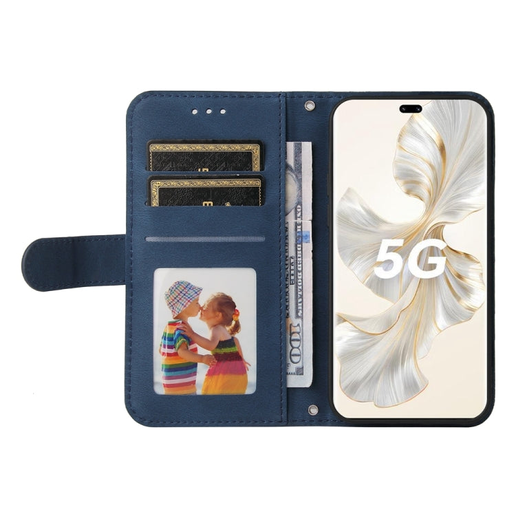 For Honor 100 Pro Skin Feel Life Tree Metal Button Leather Phone Case(Blue) - Honor Cases by PMC TechLife | Online Shopping South Africa | PMC TechLife | Buy Now Pay Later Mobicred
