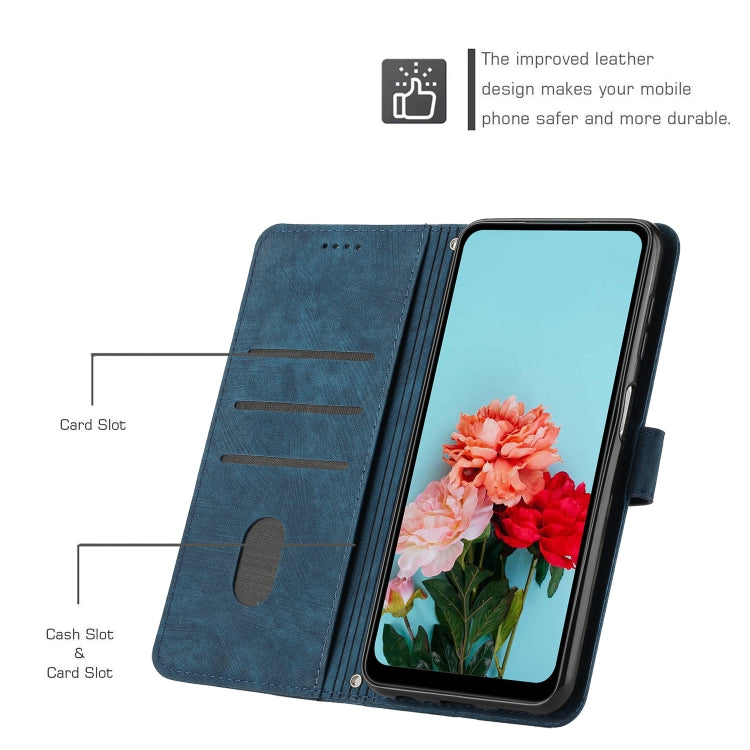 For Infinix Note 40 Pro 4G / 5G Skin Feel Stripe Pattern Leather Phone Case with Lanyard(Blue) - Infinix Cases by PMC TechLife | Online Shopping South Africa | PMC TechLife | Buy Now Pay Later Mobicred