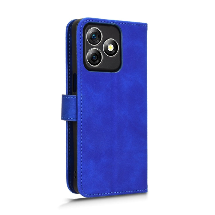 For Ulefone Note 18 Ultra Skin Feel Magnetic Flip Leather Phone Case(Blue) - Ulefone Cases by PMC Jewellery | Online Shopping South Africa | PMC Jewellery | Buy Now Pay Later Mobicred