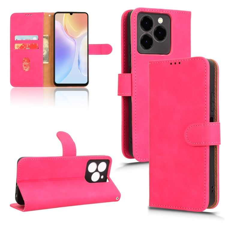 For Ulefone Note 20 Pro Skin Feel Magnetic Flip Leather Phone Case(Rose Red) - Ulefone Cases by PMC Jewellery | Online Shopping South Africa | PMC Jewellery | Buy Now Pay Later Mobicred