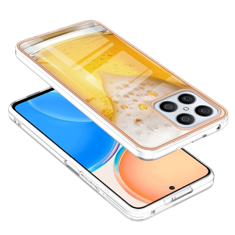 For Honor X8 4G Electroplating Marble Dual-side IMD Phone Case(Draft Beer) - free shipping - PMC TechLife - Order now!