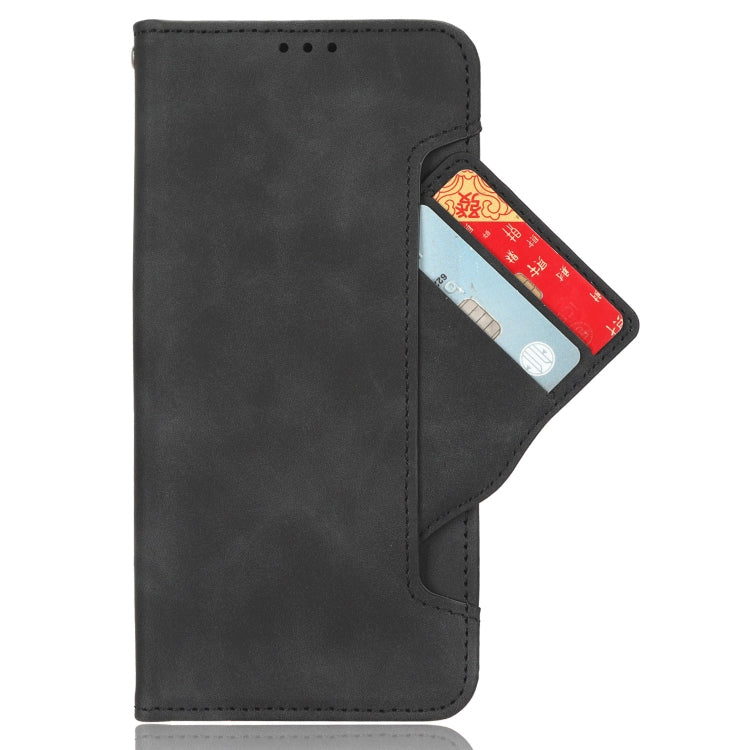 For Doogee X98 Skin Feel Calf Texture Card Slots Leather Phone Case(Black) - Doogee Cases by PMC Jewellery | Online Shopping South Africa | PMC Jewellery | Buy Now Pay Later Mobicred