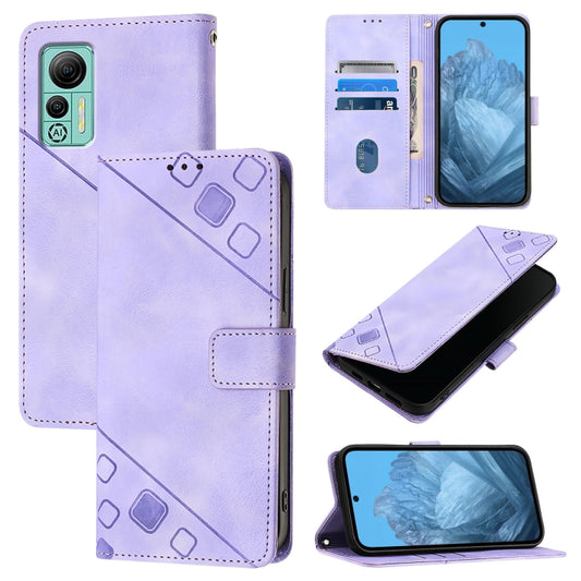 For Ulefone Note 14 Skin Feel Embossed Leather Phone Case(Light Purple) - Ulefone Cases by PMC Jewellery | Online Shopping South Africa | PMC Jewellery | Buy Now Pay Later Mobicred