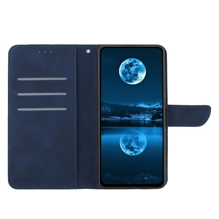 For Tecno Pova 7 Ultra 5G Stitching Embossed Leather Phone Case(Blue) - free shipping - PMC TechLife - Order now!