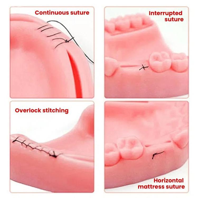 Gums Multiple Wounds Silicone Suture Practice Mold Four Teeth Oral Surgery Training Module For Medical Students - free shipping - PMC TechLife - Order now!